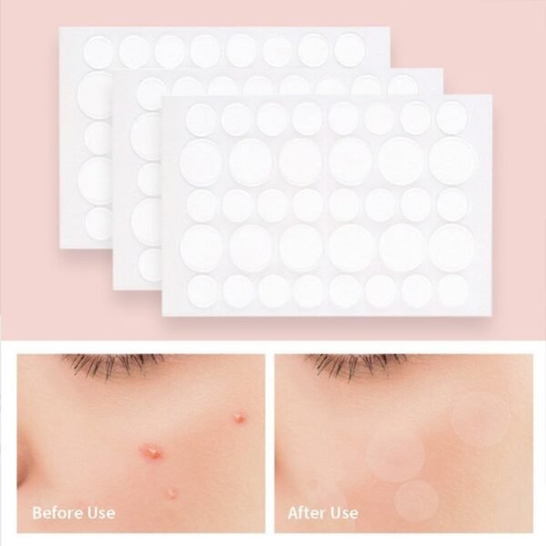 36 Patches Acne Pimple Patch Stickers - Image 5