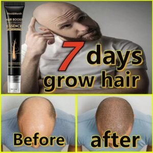 Rapid Hair Growth Essence – Combat Hair Loss